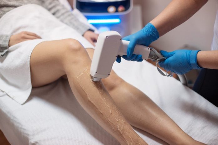 IMG_01 Лазерная эпиляция